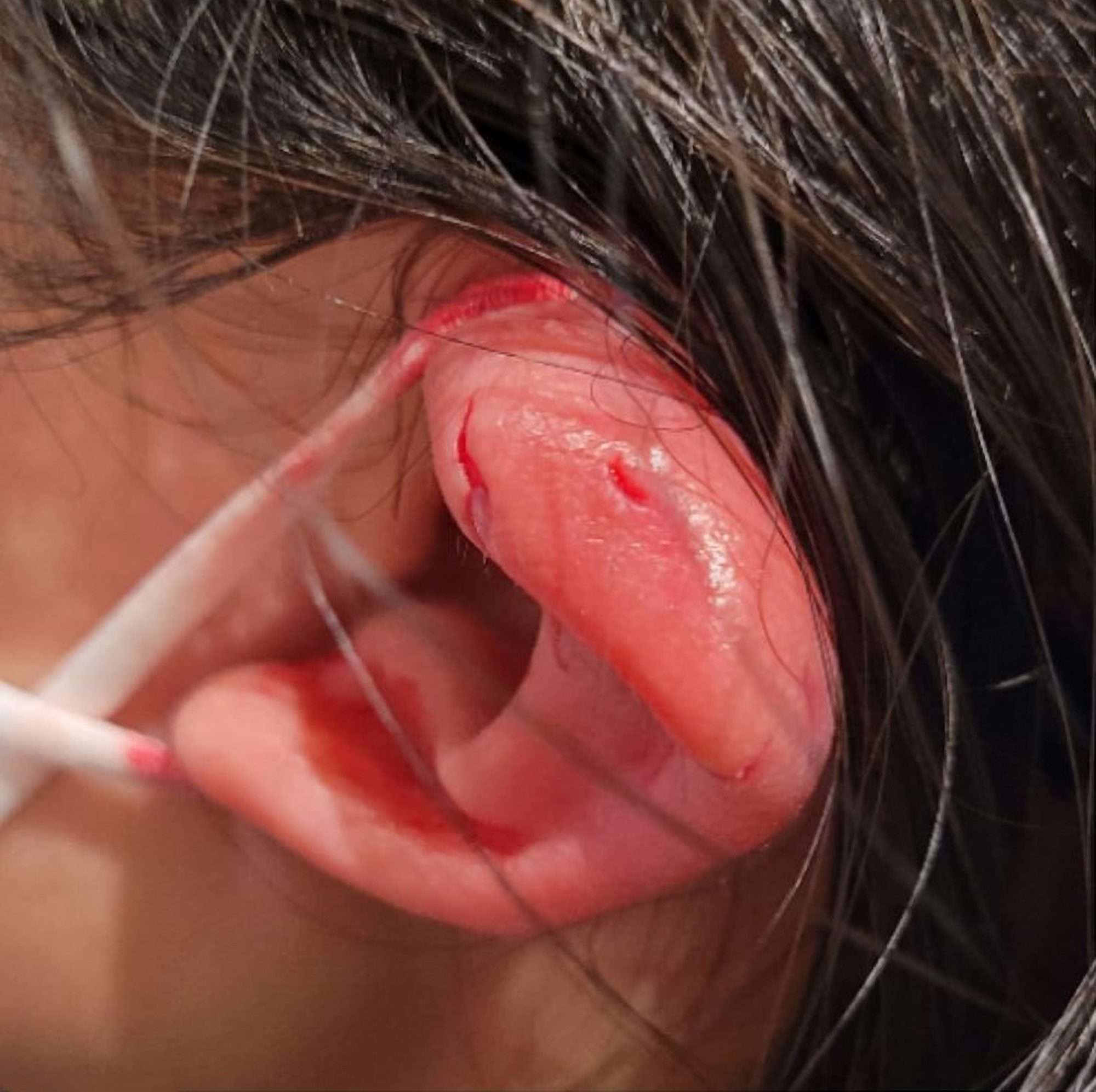 Read more about the article Bad-Tempered Cockatoo Bites Girl’s Ear